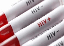 پویش «من هم تست HIV می‌دهم» انتخابی برای سلامت