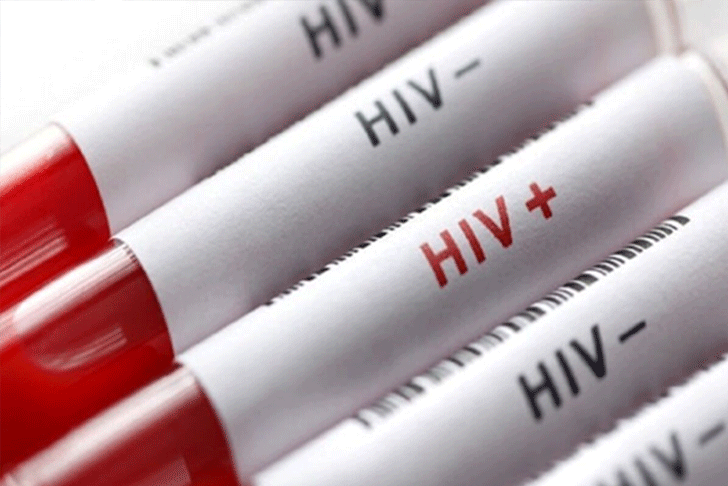 پویش «من هم تست HIV می‌دهم» انتخابی برای سلامت